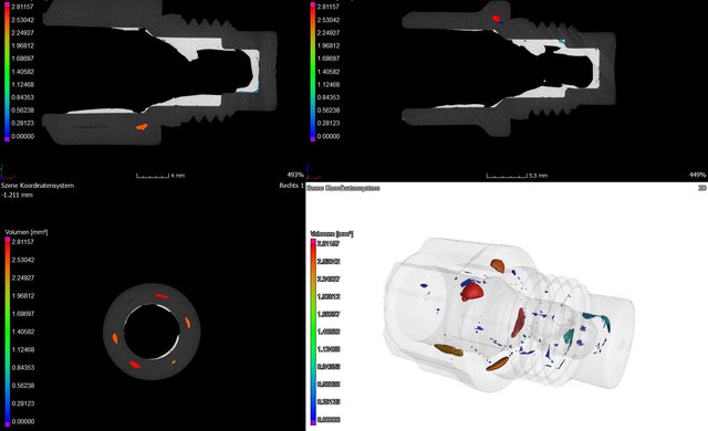 CT-Scan Lunkeranalayse